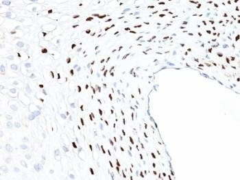 Anti-Type 16 of Human Papilloma Virus (HPV-16) HPV-16 L1 Antibody, Sodium Azide Free