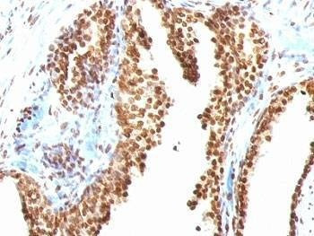 Anti-dsDNA Antibody, Sodium Azide Free