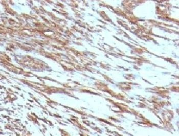 Anti-pan Muscle Actin Antibody