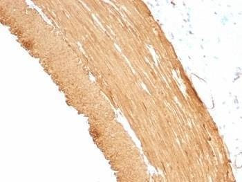 Anti-pan Muscle Actin Antibody