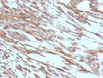 Anti-pan Muscle Actin Antibody, Sodium Azide Free