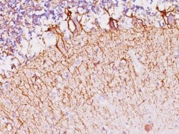 Anti-Neurofilament Antibody, Sodium Azide Free