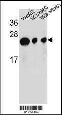 Anti-ATP5H (Center) Antibody