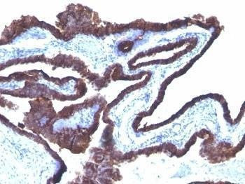 Anti-Cytokeratin 8 + 18 Antibody Cocktail