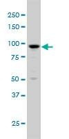 Anti-ARHGAP6 Antibody