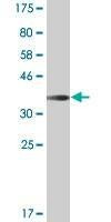 Anti-ARHGAP6 Antibody