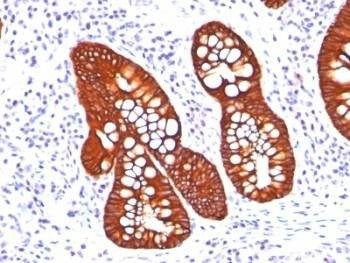 Anti-Cytokeratin 19 Antibody Cocktail, Sodium Azide Free
