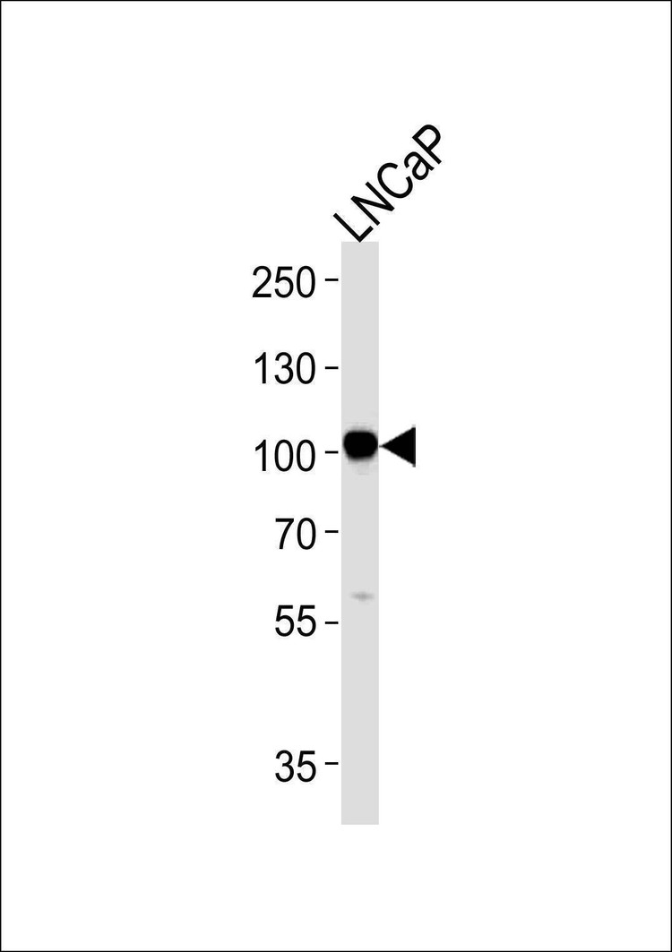 Anti-MME (C-term) Antibody