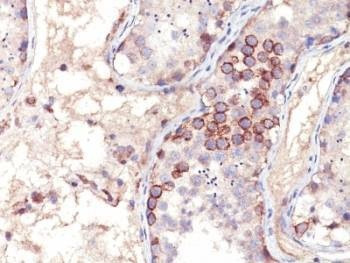 Anti-MAGE-1 Antibody