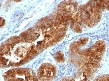Anti-TAG-72 Antibody Cocktail, Sodium Azide Free