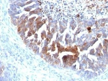 Anti-TAG-72 Antibody Cocktail, Sodium Azide Free