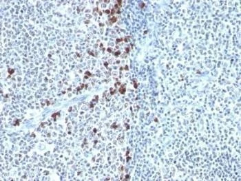 Anti-Kappa Light Chain Antibody