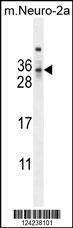 Anti-MAF1 (Center) Antibody