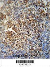 Anti-MAF1 (Center) Antibody