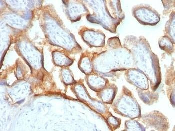 Anti-HCG-beta Antibody Cocktail