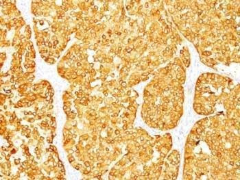 Anti-Melan-A Antibody Cocktail