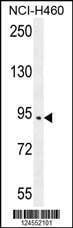 Anti-SPARCL1 (Center) Antibody