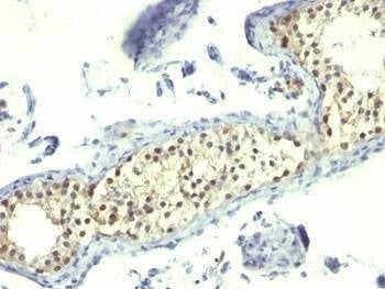 Anti-Thymidylate Synthase Antibody