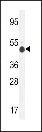 Anti-GCNT2 (C-term) Antibody