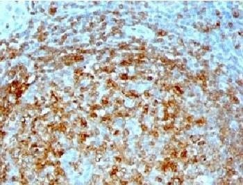 Anti-CLIP Antibody