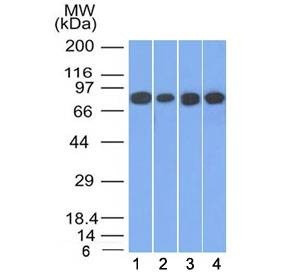 Anti-Gamma Catenin / Plakoglobin Antibody, Sodium Azide Free