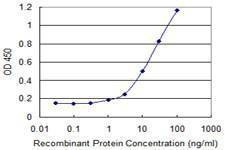 Anti-ARHGAP6 Antibody
