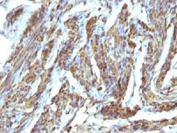 Anti-Calponin Antibody, Sodium Azide Free