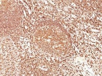 Anti-CD45 Antibody (Leukocyte marker), Sodium Azide Free