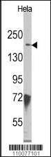 Anti-JMJD3 (N-term) Antibody