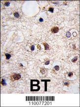 Anti-JMJD3 (N-term) Antibody