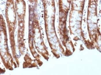 Anti-Beta Catenin Antibody, Sodium Azide Free
