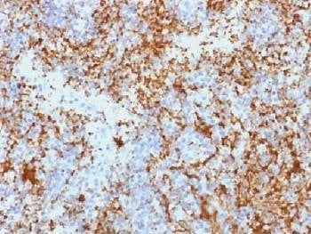 Anti-Integrin beta 3 / ITGB3 / CD61 Antibody, Sodium Azide Free