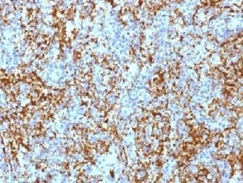 Anti-Integrin beta 3 / ITGB3 / CD61 Antibody, Sodium Azide Free