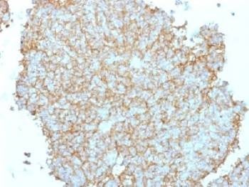 Anti-CD99 Antibody, Sodium Azide Free