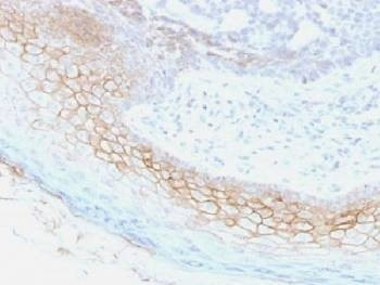 Anti-Desmocollin 2/3 Antibody, Sodium Azide Free