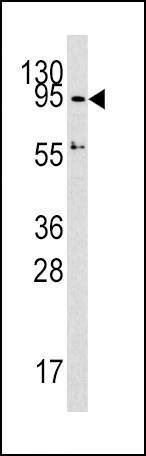 Anti-Dnmt3A/Dnmt3A2 (C-term) Antibody