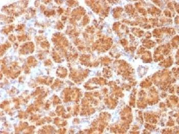 Anti-Clatherin Light Chain Antibody (LCA/LCB), Sodium Azide Free