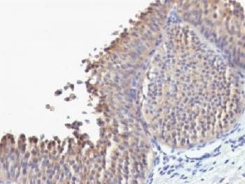 Anti-Cytokeratin 10 Antibody, Sodium Azide Free