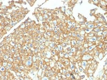 Anti-EpCAM Antibody, Sodium Azide Free