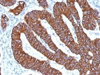 Anti-Cytokeratin 8/18 Antibody, Sodium Azide Free