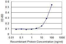 Anti-ARHGDIB Antibody