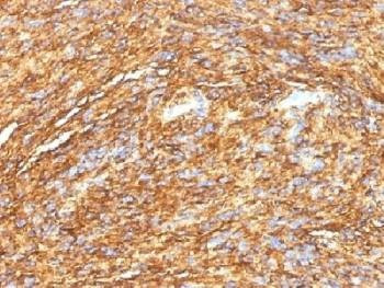 Anti-DOG1 / TMEM16A / ANO1 Antibody, Sodium Azide Free