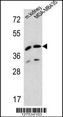 Anti-L2HGDH (Center) Antibody