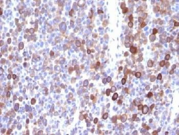 Anti-Moesin Antibody, Sodium Azide Free