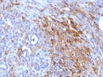Anti-Ferritin Antibody (light chain) / FTL1, Sodium Azide Free