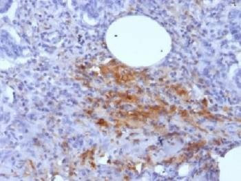 Anti-Ferritin Antibody (light chain) / FTL1, Sodium Azide Free
