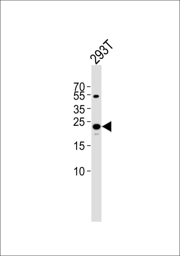 Anti-TFAM (C-term) Antibody