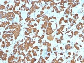 Anti-Growth Hormone Antibody (pituitary), Sodium Azide Free