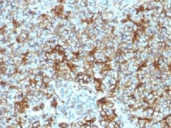 Anti-SPTBN2 / Spectrin beta III Antibody, Sodium Azide Free