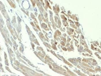 Anti-NSE Antibody, Sodium Azide Free